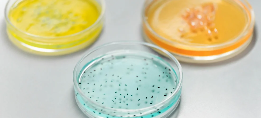 Three color-coded reagent containers (yellow, teal, orange) with dotted patterns in shallow dishes on a light surface, used for cyanuric acid testing in hot tub water.